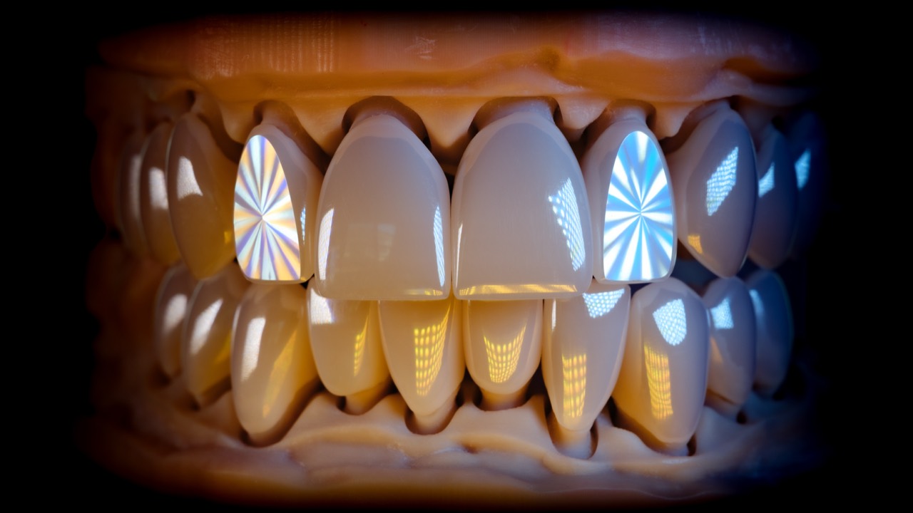 Diamond cut veneer yüzeyinde ışık kırılması — Elter cilasının imzası